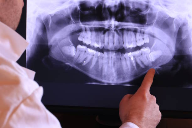 Best After-Hours Dental Trauma Care in Marks, MS