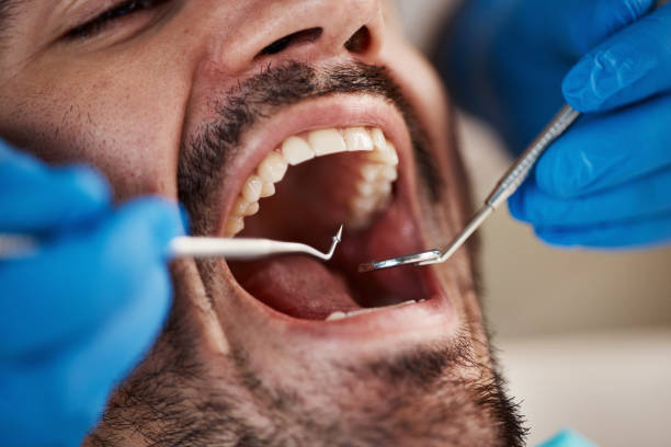 Best Emergency Tooth Extraction in Marks, MS